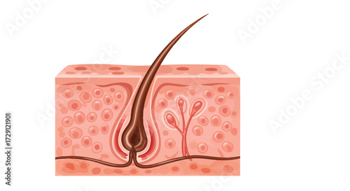 Illustration of a hair follicle in the skin, showing the hair shaft and root.