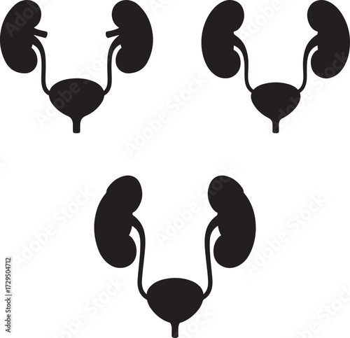 Three black silhouette diagrams of the human urinary system isolated on white background