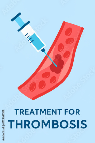 A flat vector illustration of a medical syringe injecting treatment for thrombosis, with a blood vessel in the background