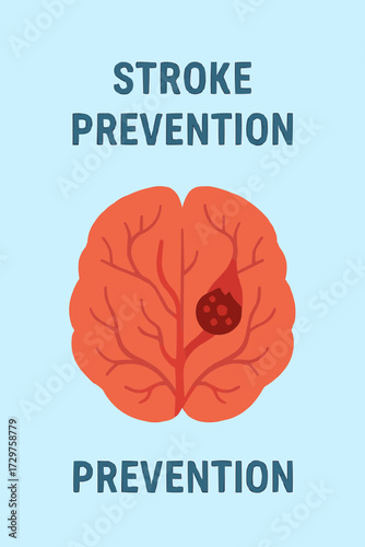 A flat vector illustration of a thrombosis clot in a brain artery, designed for stroke prevention campaigns