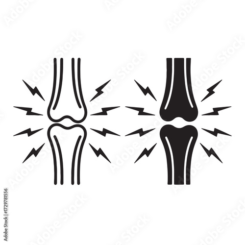 Knee Pain Representation with Anatomical Bone Structure and Pain Indicators, Illustrating Medical Condition and Discomfort