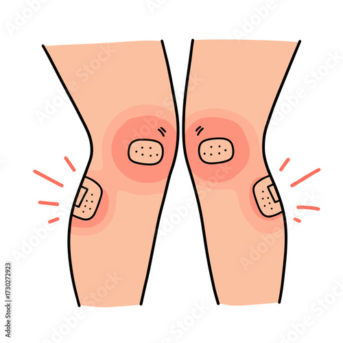 Injured knees with adhesive bandages and redness illustration  