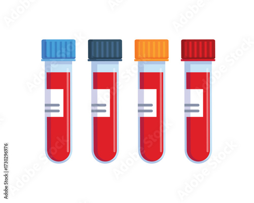 Set of medical test tubes with blood sample vector illustration isolated on white bacground. Laboratory research concept for biochemistry and viruses. Blood test tube with label. 