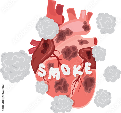 The Damaging Effects of Smoking on the Human Heart
