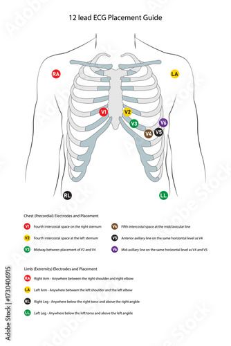 portrait electrocardiograph guide placement