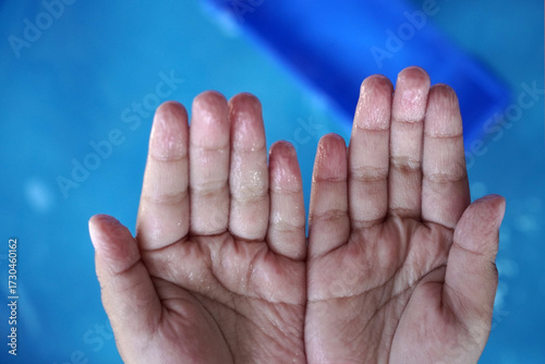 Fotografie A close-up shot of a boy's hand with wrinkled fingertips after being submerged in water
