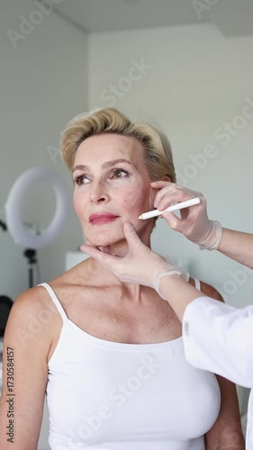 Mature woman on cosmetic consultation in aesthetic clinic, dermatologist marking lifting lines on face, planning non-surgical facelift, professional anti-aging skincare and beauty treatment