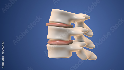 Medical Visualization of Kyphoplasty and Vertebroplasty Treatment