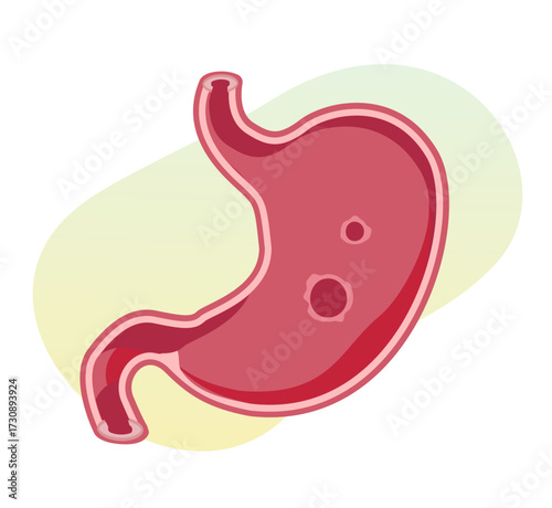 Peptic Ulcer - Stomach Ache - Illustration