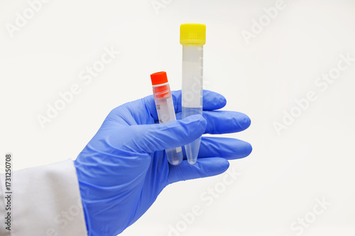 A laboratory worker holds two sample tubes