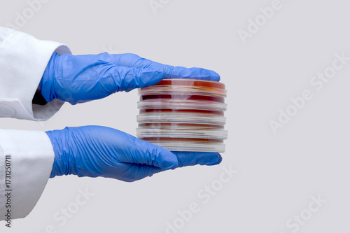 Photos A laboratory worker holds several petri dishes with bacterial cultures