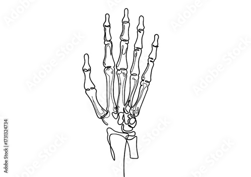 World Osteoporosis Day