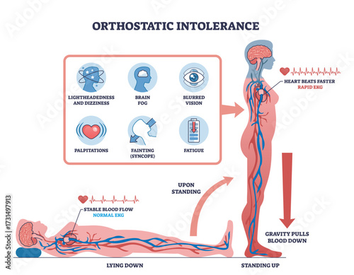 Orthostatic intolerance is shown with a person standing, blood flow changes, and symptom icons to illustrate effects of posture change. Outline diagram