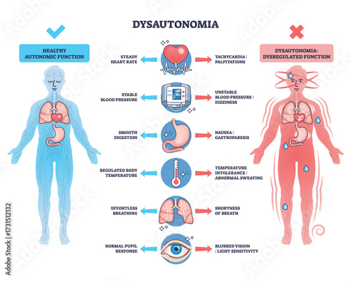 Dysautonomia overview showing differences in autonomic function with human figures, organs, and symptom icons. Outline diagram