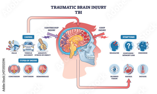Traumatic brain injury is shown with a side-view head, brain impact zones, and labeled symptoms and causes. Outline diagram
