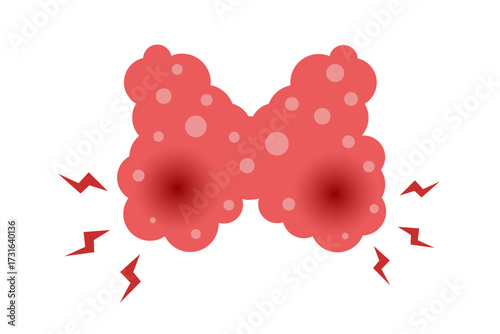 thyroid disease concept. vector illustration