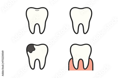 Tooth stages icon set vector. Molar collection showing healthy, clean, decayed with caries, and in gum. Concepts for dentistry, oral hygiene, dental care, clinic, and health.