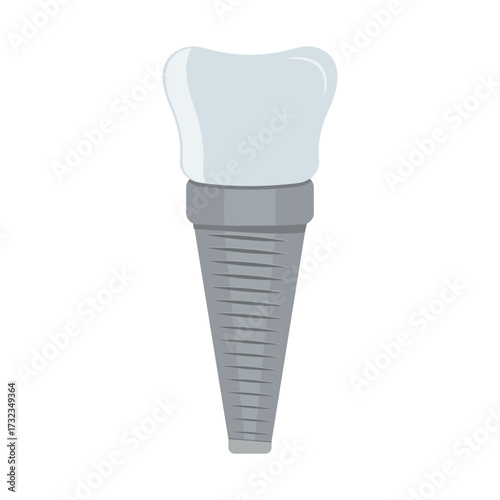 Dental implant. Screw prosthesis, Illustration of dental implantation,orthodontic dental implantation