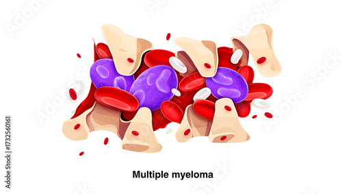 Bone marrow cells red purple white bone fragments blood
