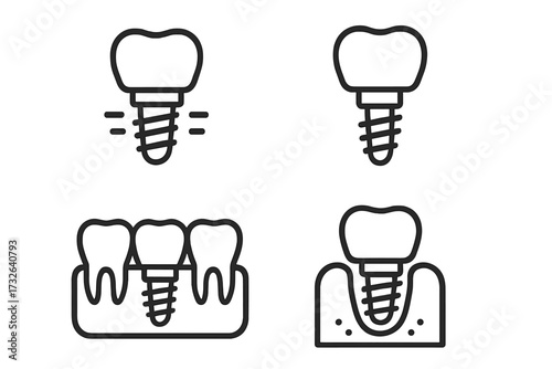 Dental implant icon set. Minimalistic line art pictogram. Dentistry, tooth restoration, prosthesis, stomatology concept. Jawbone surgery and gum installation vector illustration.