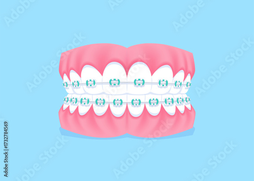 Full mouth teeth - Orthodontics illustration vector design. Dental care concept.