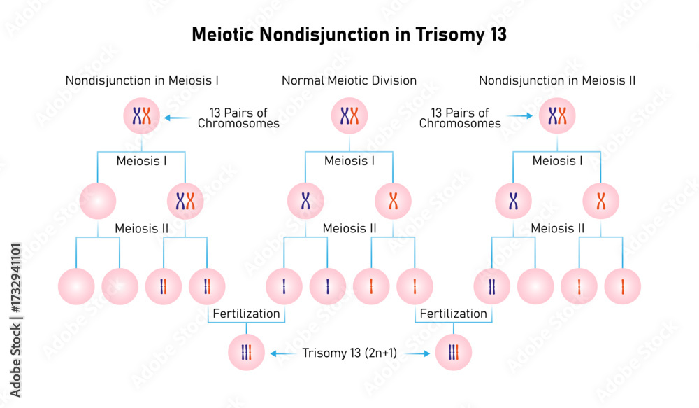 Naklejka premium Meiotic Nondisjunction in Trisomy 13 Science Design. Vector Illustration.