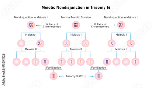 Meiotic Nondisjunction in Trisomy 16 Science Design. Vector Illustration.