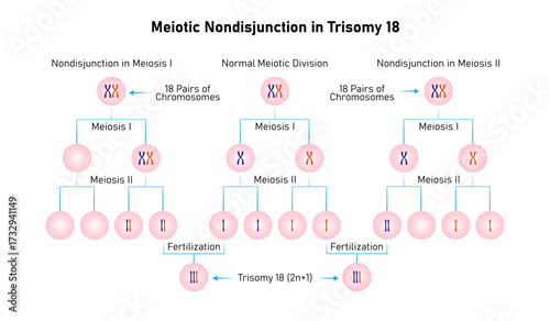 Meiotic Nondisjunction in Trisomy 18 Science Design. Vector Illustration.