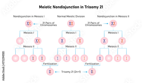 Meiotic Nondisjunction in Trisomy 21 Science Design. Vector Illustration.