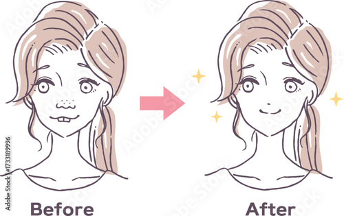 美容整形のビフォーアフターベクターイラスト素材