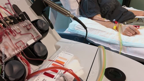 Blood Returning to Patient from Apheresis Machine. Clinical healthcare footage highlighting transfusion process, cancer treatment and modern medical technology in action.
