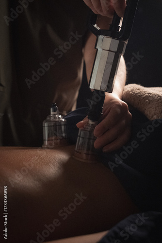 Close up cupping massage therapy treatment