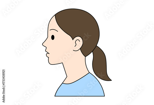 Comparison of female side profiles showing overbite and normal alignment, medical dental orthodontic illustration for healthcare and educational use