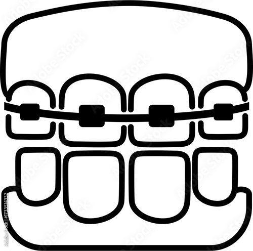 Teeth braces
