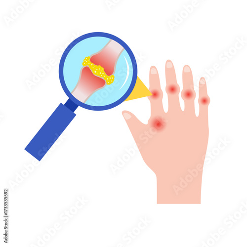 gout disease concept. vector illustration
