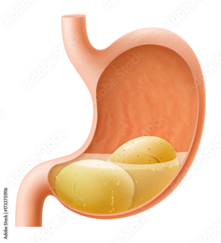 Human Stomach with potato. The stomach digests potatoes. A stomach filled with healthy and wholesome food. Proper nutrition. Realistic 3d Vector illustration. Food digestion process illustration