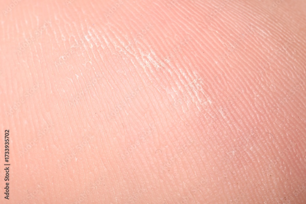 Fototapeta premium Macro view of dry human skin with wrinkles as background