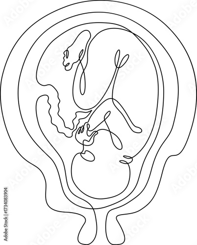 Continuous one line drawing Human embryo. Development of the human fetus. Pregnancy.Line art.One continuous line isolated illustration.Not AI.