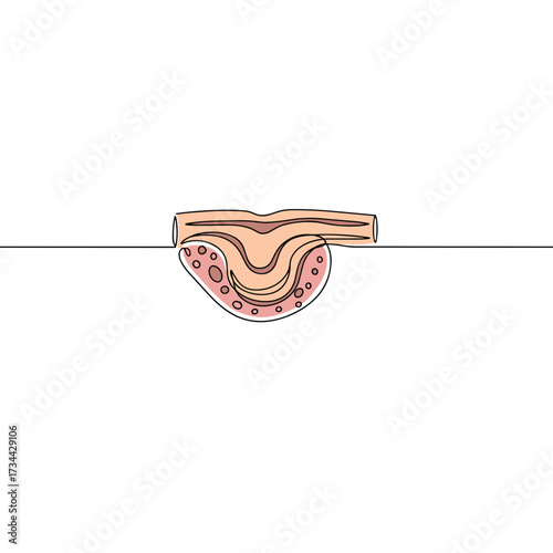 Cross-section illustration of skin with contact dermatitis condition  