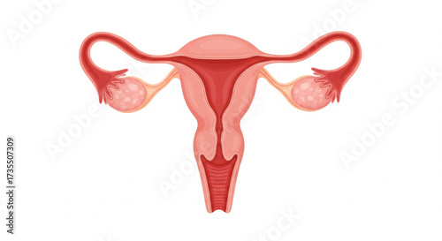 Illustration of the female reproductive system, showing ovaries, fallopian tubes, uterus, and cervix.