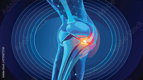 Diagram of a knee joint labeled with Osteoarthritis of the Knee  highlighting the condition's impact on joint health..eps