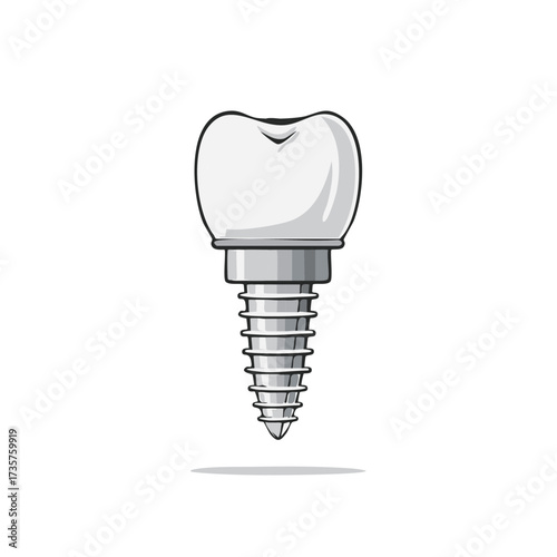 Illustration of Tooth Implant for Dental Care and Prosthetic Dentistry Promotion