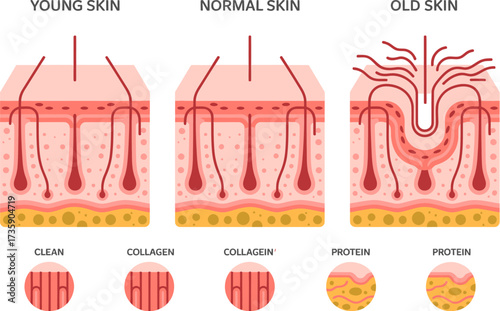 Skin aging process illustration showing young normal and old skin changes