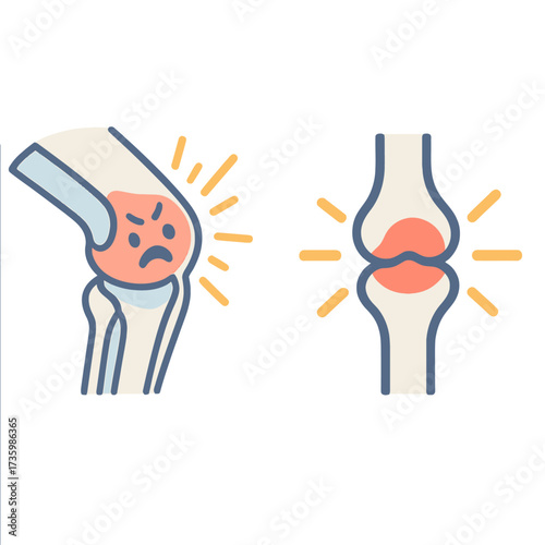 An illustrative icon set depicting painful knee joints and inflammation, symbolizing various musculoskeletal conditions and the need for medical attention or relief.