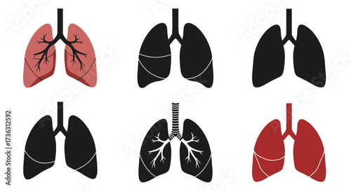 Illustration depicting healthy and unhealthy human lungs in varying stages