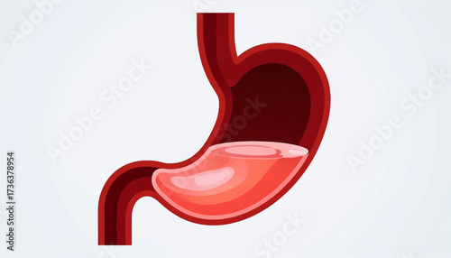 A simplified anatomical illustration of the human stomach, showing internal structure and contents.
