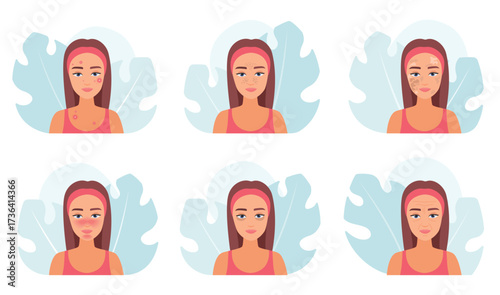 Skin problems set vector illustration. Cartoon infographic medical collection of female characters with derma troubles on face of aging and puberty, acne disease and wrinkles, allergy and melasma