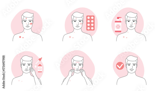 Acne treatment for man infographic line icon set vector illustration. Hand drawn outline guys treat rash of pimples with pills, puberty facial problem, apply skincare liquid products, ointment on skin