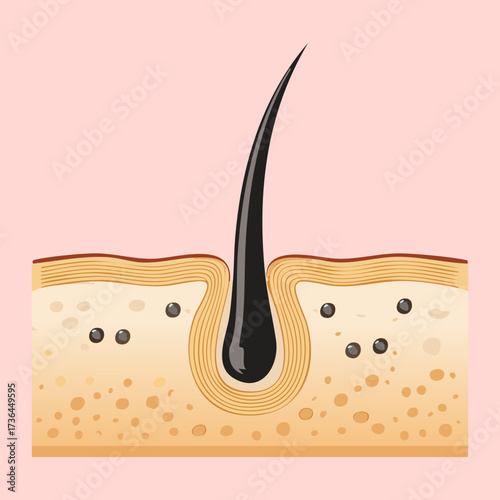 Simplified diagram showing hair follicles within the skin with small dirt particles affecting the scalp hygiene