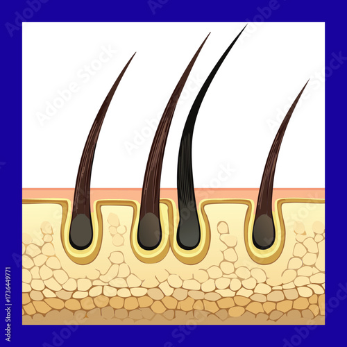 Detailed educational graphic of several hair follicles penetrating the epidermis and dermis layers of healthy human skin